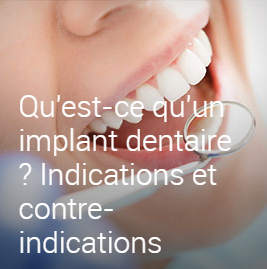 Dentiste-Metz-57000-Dr-MOLE-François-03-87-74-05-25